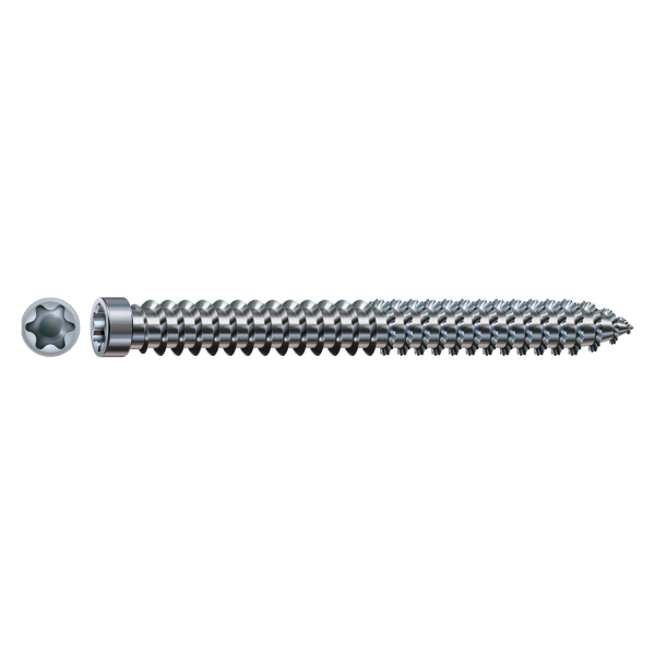SPAX-Ra 1031010751005 Kozijnschroef - T-STAR Plus T30 - 7.5 X 100mm - Cilinderkop - Voldraad - WIROX (100st)